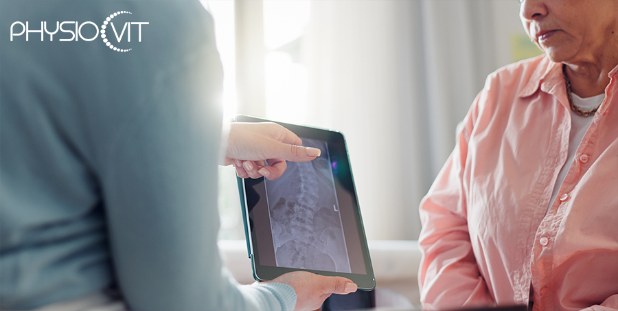 Az idiopátiás gerincferdülés jelentősége és hosszú távú hatásai