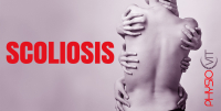 Képzelje el a gerincét, mint egy hajlékony fát – de mi történik, ha ez az egyensúly felborul? Tudjon meg mindent a gerincferdülés okairól, típusairól, felismeréséről és a modern kezelési lehetőségekről, mint a Schroth terápia, fűző és gyógytorna. Ismerje meg, hogyan élhet teljes életet gerincferdüléssel is!